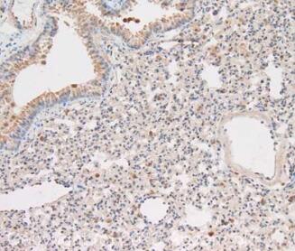 Anti-Caspase-1抗体