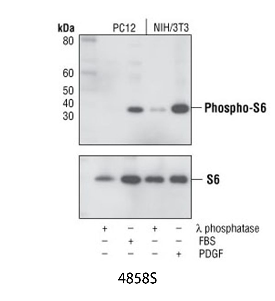 Phospho-S6 Ribosomal Protein (Ser235/236) (D57.2.2E) XP Rabbit mAb