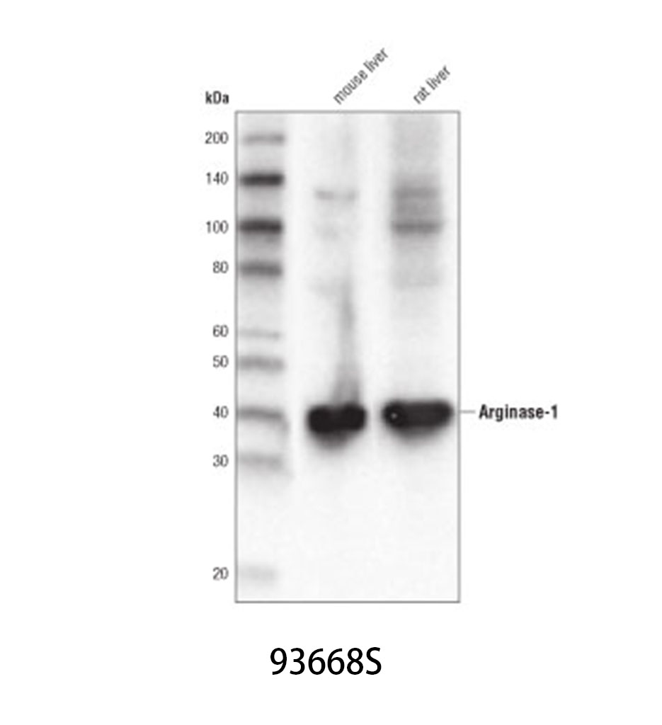 Arginase-1 (D4E3M) XP Rabbit mAb