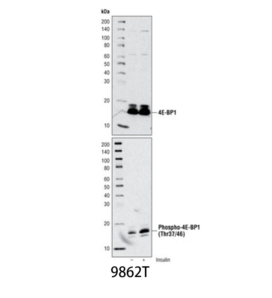 mTOR Substrates Antibody Sampler Kit