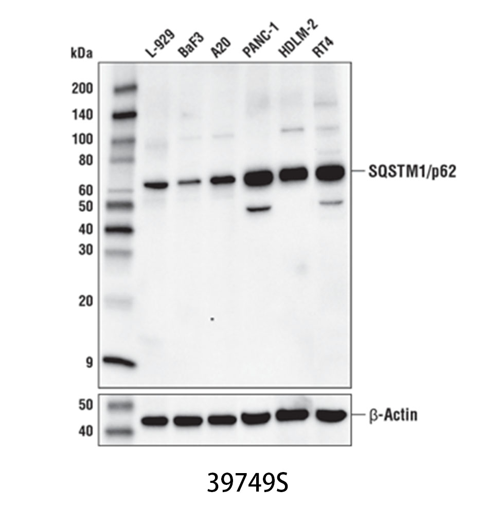 SQSTM1/p62 (D1Q5S) Rabbit mAb