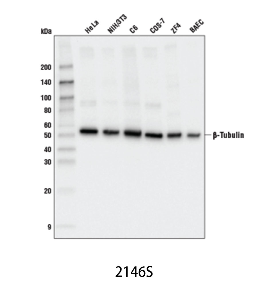 β-Tubulin Antibody