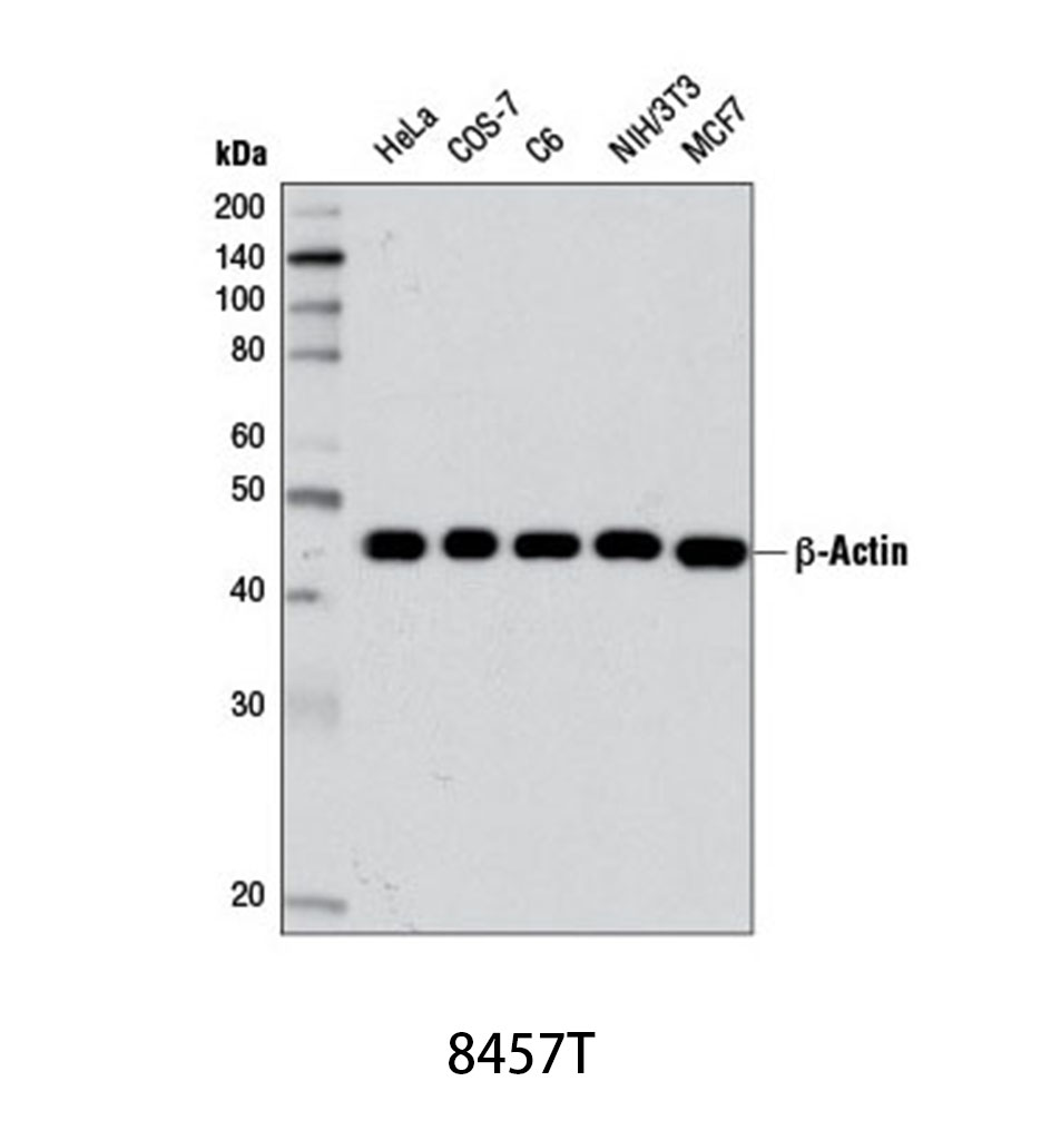 β-Actin (D6A8) Rabbit mAb