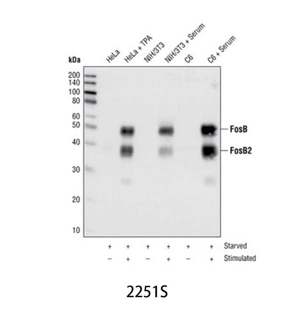 FosB (5G4) Rabbit mAb