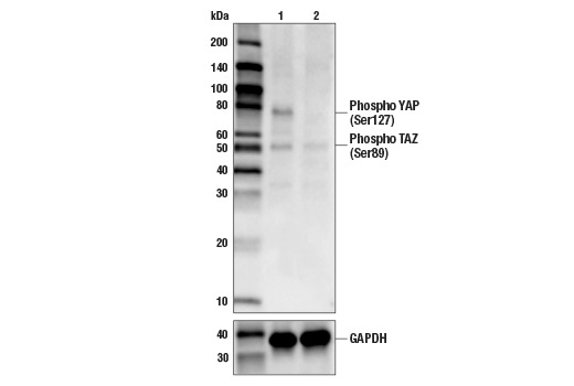 Hippo Signaling Antibody Sampler Kit