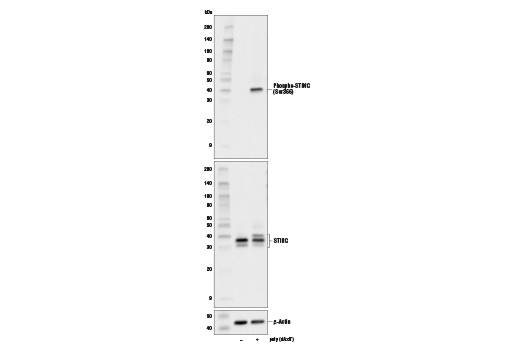 Phospho-STING (Ser366) (D7C3S) Rabbit mAb