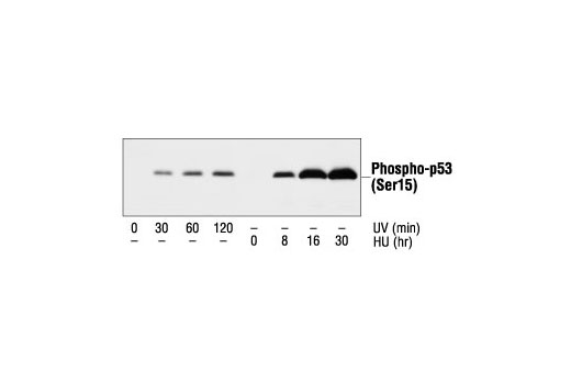 Phospho-p53 (Ser15) Antibody