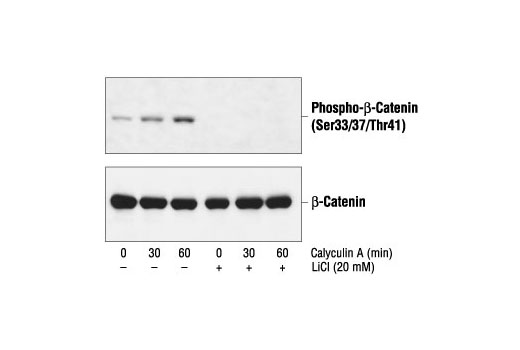 Phospho-β-Catenin (Ser33/37/Thr41) Antibody