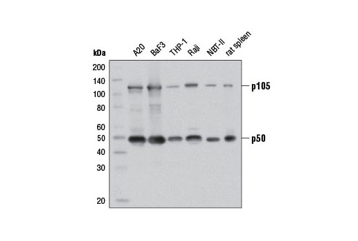 NF-κB1 p105/p50 (D4P4D) Rabbit mAb
