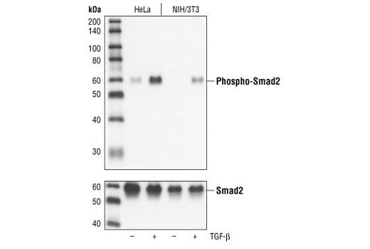 Phospho-Smad2 (Ser465/467) (138D4) Rabbit mAb