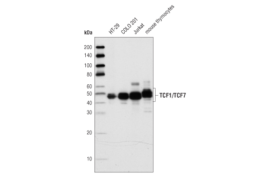 TCF1/TCF7 (C63D9) Rabbit mAb