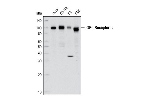 IGF-I Receptor β Antibody