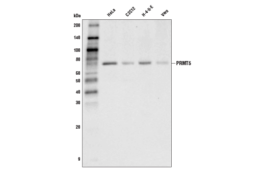 PRMT5 (D5P2T) Rabbit mAb