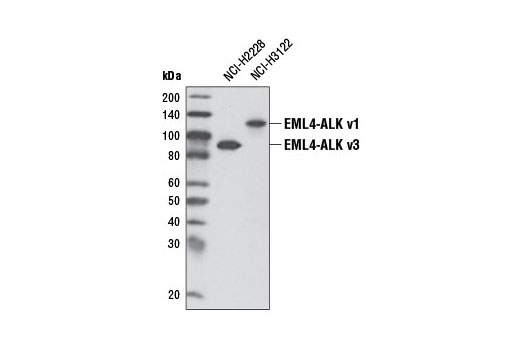 ALK (D5F3) XP Rabbit mAb