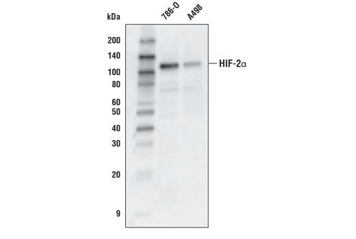 HIF-2α (D6T8V) Rabbit mAb