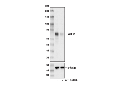 ATF-2 (D4L2X) XP Rabbit mAb