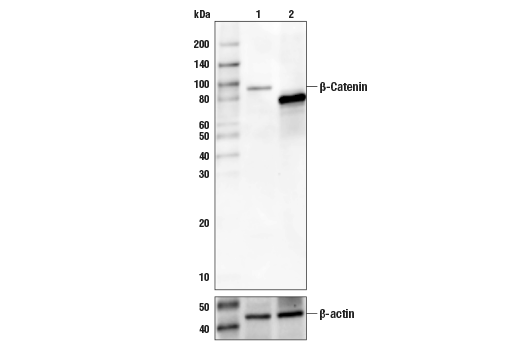 β-Catenin Antibody (Carboxy-terminal Antigen)