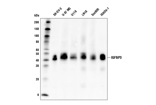 IGFBP3 (D1U9C) Rabbit mAb