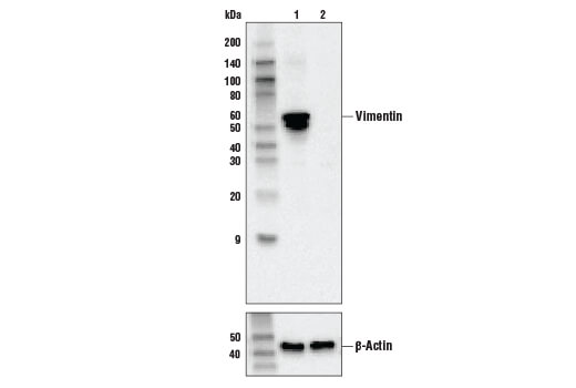 Vimentin (R28) Antibody