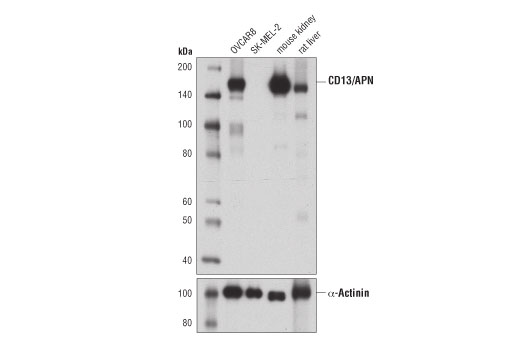 CD13/APN (D6V1W) Rabbit mAb