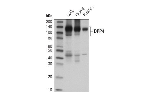 DPP4/CD26 (D6D8K) Rabbit mAb
