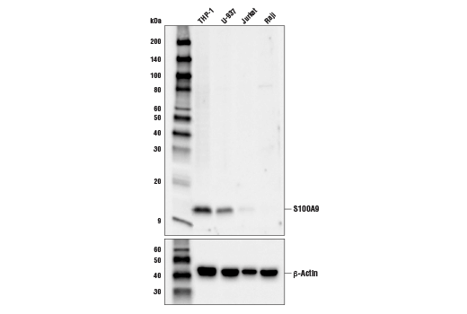 S100A9 (D5O6O) Rabbit mAb