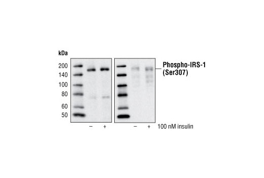IRS-1 Inhibition Antibody Sampler Kit