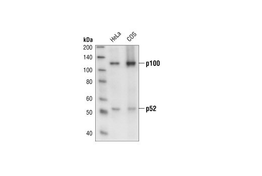 NF-κB2 p100/p52 (18D10) Rabbit mAb