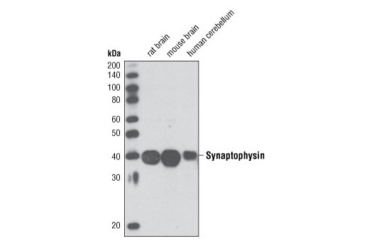 Synaptophysin Antibody