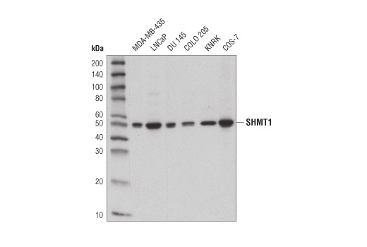 SHMT1 (D3B3J) Rabbit mAb