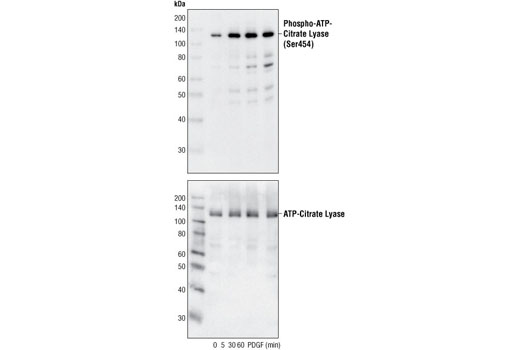 Phospho-ATP-Citrate Lyase (Ser455) Antibody