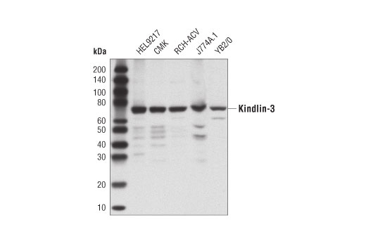 Kindlin-3 (D8I7V) Rabbit mAb