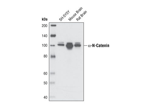 α-N-Catenin (C12G4) Rabbit mAb