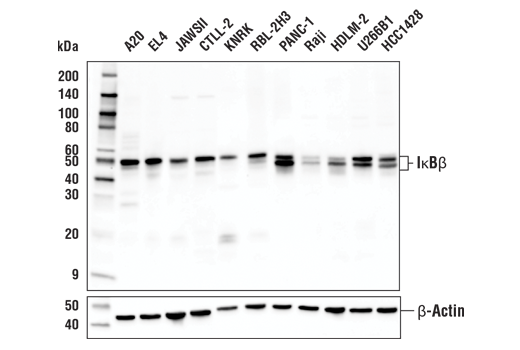 IκBβ (D1T3Z) Rabbit mAb