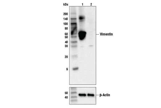 Vimentin (V9) Mouse mAb