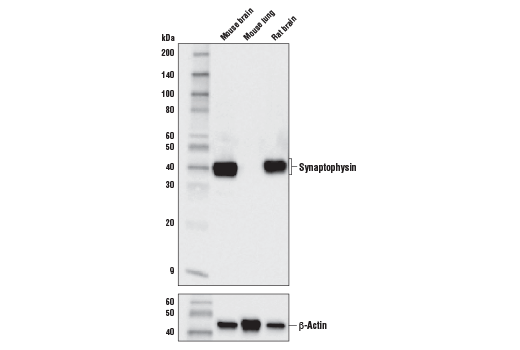 Synaptophysin (D8F6H) XP Rabbit mAb