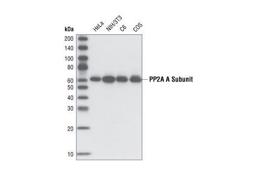PP2A A Subunit (81G5) Rabbit mAb