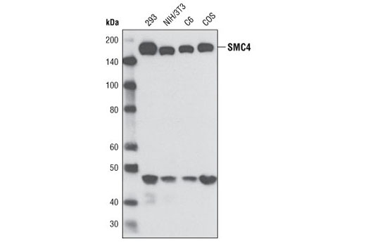 SMC4 (D14E2) Rabbit mAb