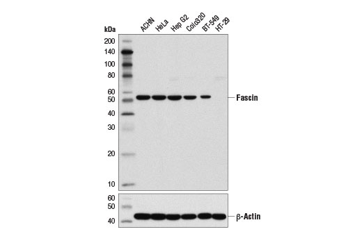Fascin (55k-2) Mouse mAb