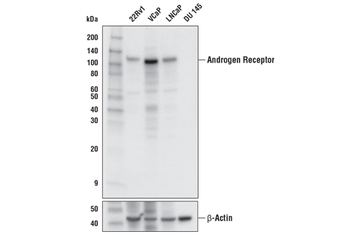 Androgen Receptor (E3S4N) Rabbit mAb (Carboxy-terminal Antigen)