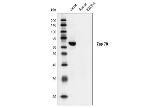 Zap-70 (L1E5) Mouse mAb