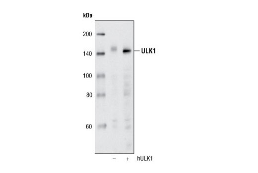 ULK1 (R600) Antibody