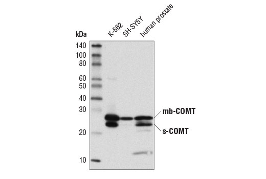 COMT (D4N6M) Rabbit mAb