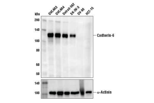 Cadherin-6 (D3T3I) Rabbit mAb