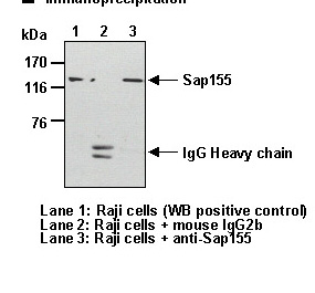 Anti-Sap155 mAb