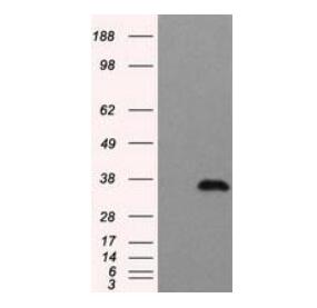 10F11, Anti-TYFP mouse monoclonal Antibody