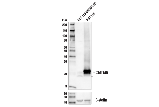 CMTM6 (E5B1F) Rabbit mAb