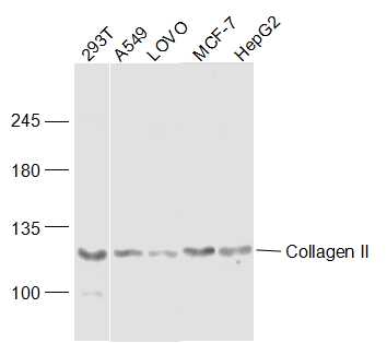 Ⅱ型胶原蛋白抗体