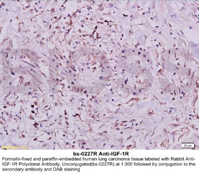 胰岛素样生长因子I受体抗体