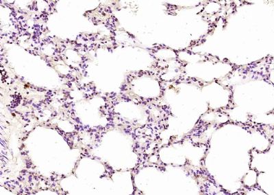 核受体0相关蛋白B家族2抗体